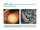 Radial endosonography atlas endoscopic and ultrasound interpretation. Vladimir Romanov