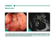 Radial endosonography atlas endoscopic and ultrasound interpretation. Vladimir Romanov